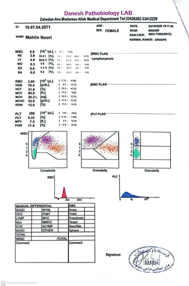 حساسیت به پروتئین گاوی