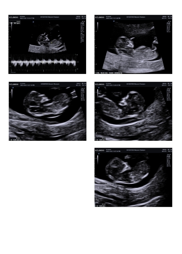 تفسیر سونو ان تی تفسیر سونو ان تی