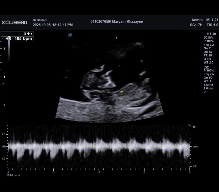 تفسیر سونو ان تی تفسیر سونو ان تی