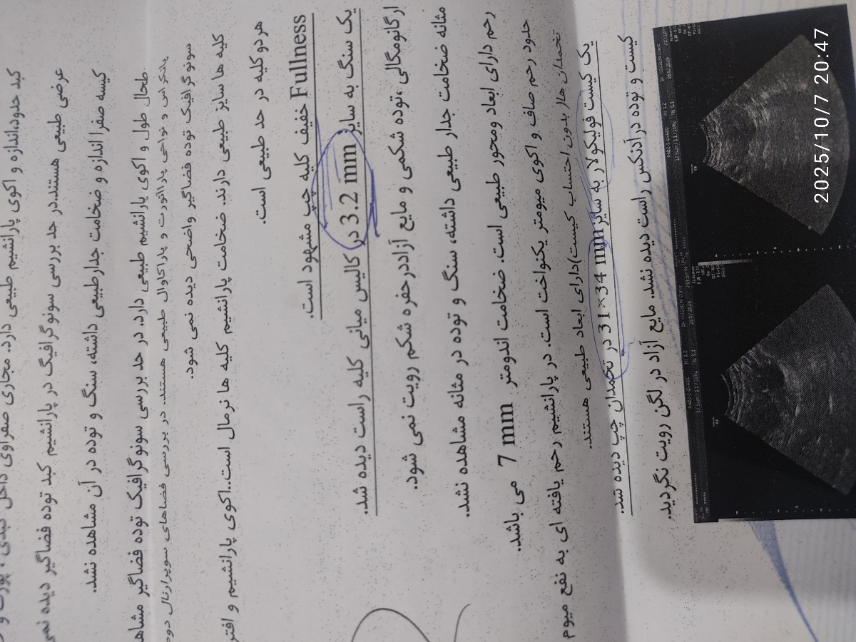تفسیر سونوگرافی کیست تخمدان