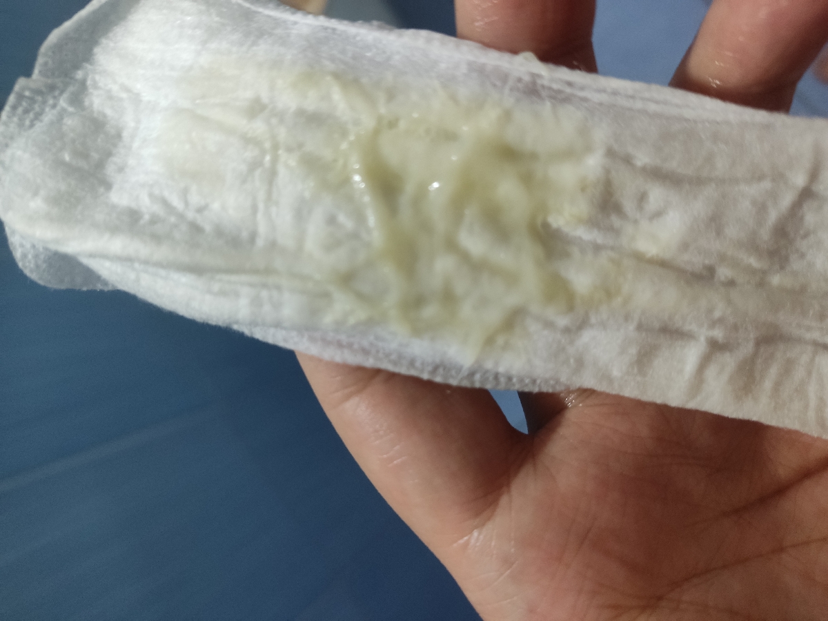 خارش و عفونت مکرر+عکس