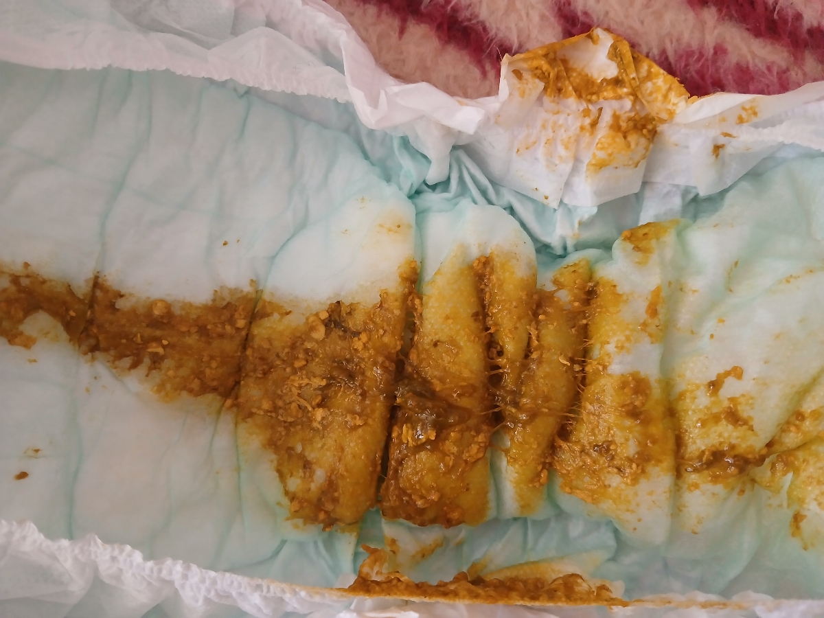 مدفوع پسرم چند روزه اینجوری شده علتش چیه؟ مدفوع پسرم چند روزه اینجوری شده علتش چیه؟