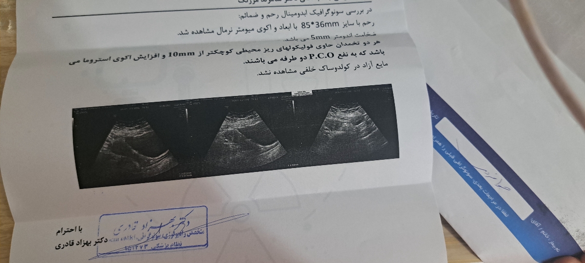 تفسیر سونوگرافی رحم تفسیر سونوگرافی رحم