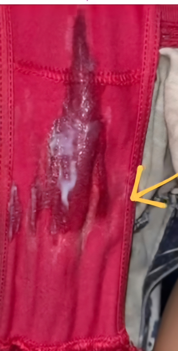 این عکس رو از اینترنت گرفتم ولی تازگیا این مدل ترشح هم زیاد دارم این عکس رو از اینترنت گرفتم ولی تازگیا این مدل ترشح هم زیاد دارم