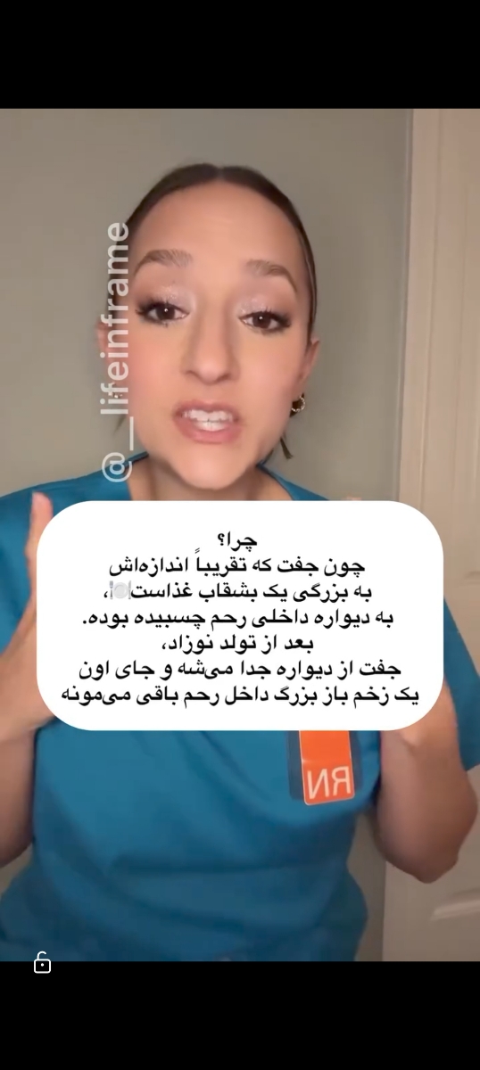 بارداری بعد از زایمان بارداری بعد از زایمان