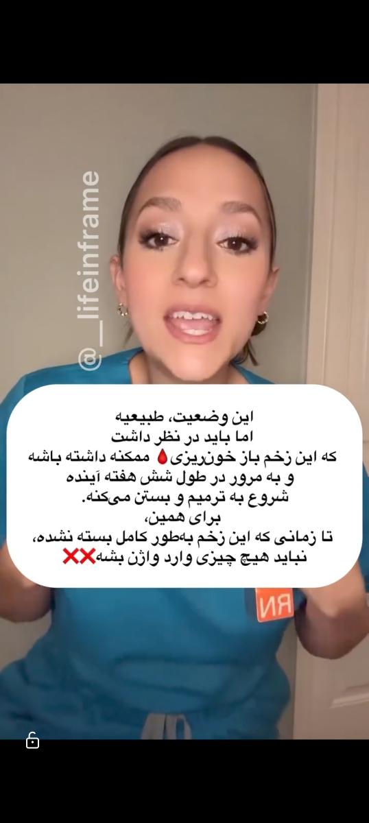 بارداری بعد از زایمان بارداری بعد از زایمان