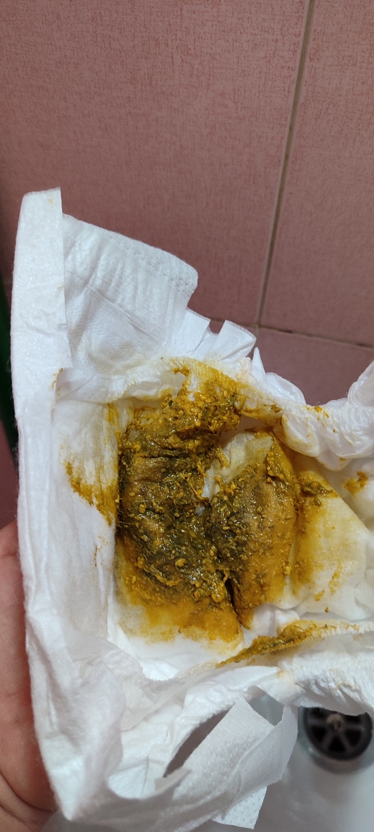 ترشح نوزادی از بدن نوزاد ترشح نوزادی از بدن نوزاد