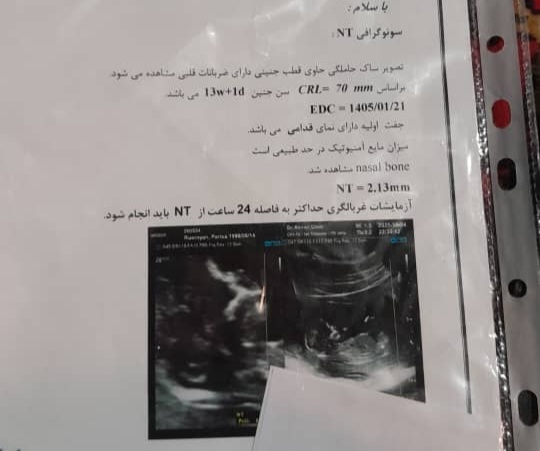 اوژانسی خانم دکتر ازمایش ان تی دادم گفته بچه مشکل داره باید سقط بشه