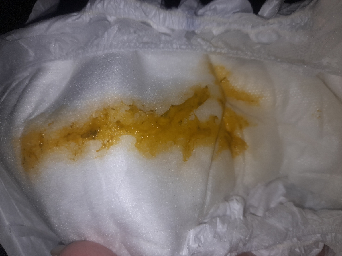 آیا مدفوع نوزادم طبیعیه یا مشکل داره ؟