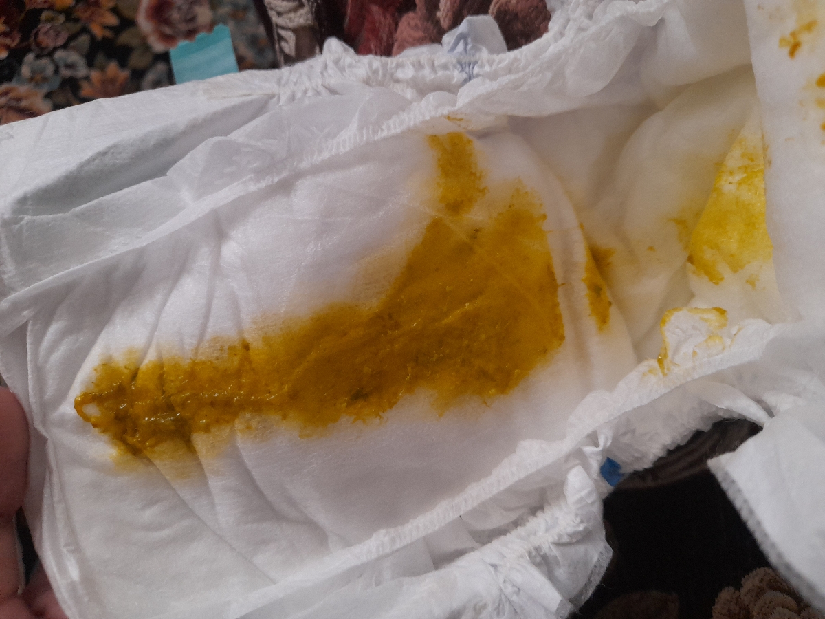 آیا مدفوع نوزادم طبیعیه یا مشکل داره ؟