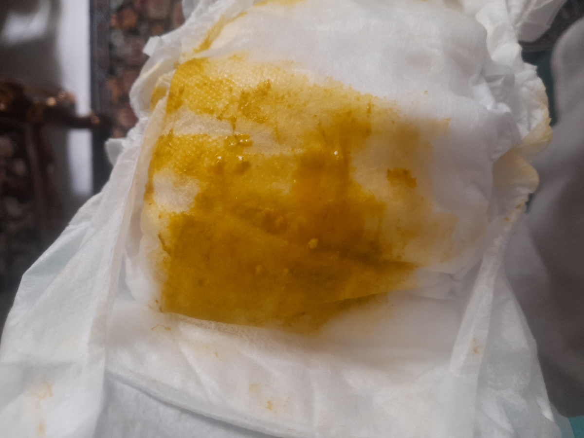 آیا مدفوع نوزادم طبیعیه یا مشکل داره ؟