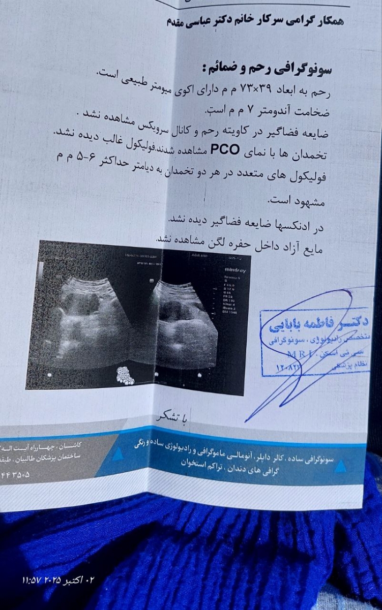 ریزش مو و سونوگرافی