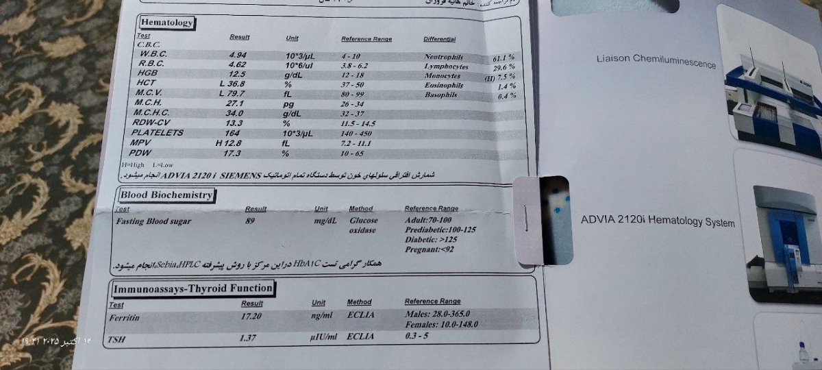 ریزش مو و سونوگرافی