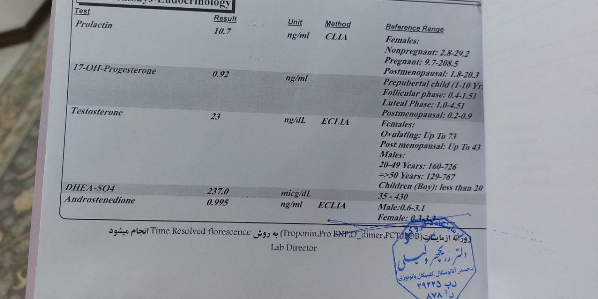 ریزش مو و سونوگرافی