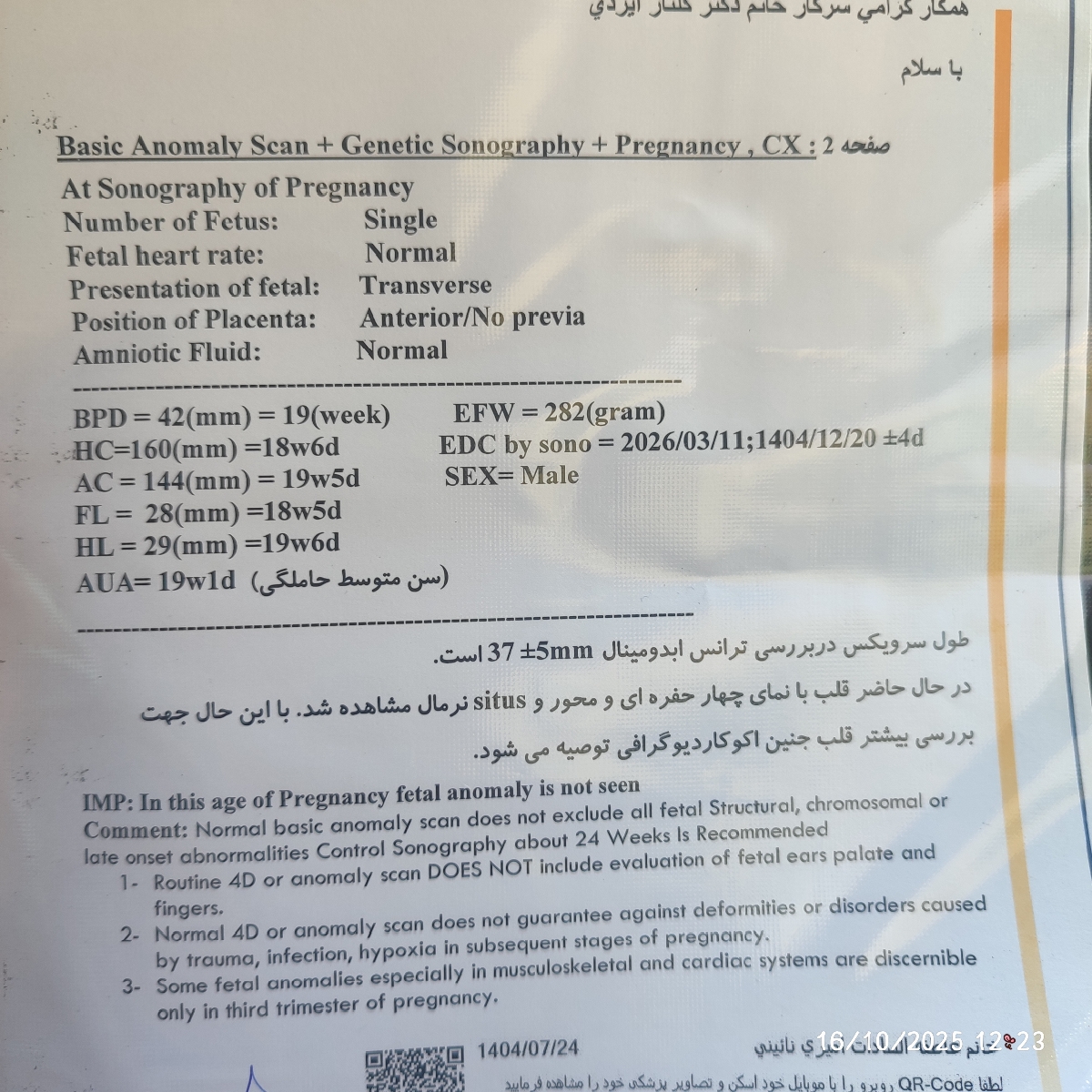 تفسیر سونو آنومالی