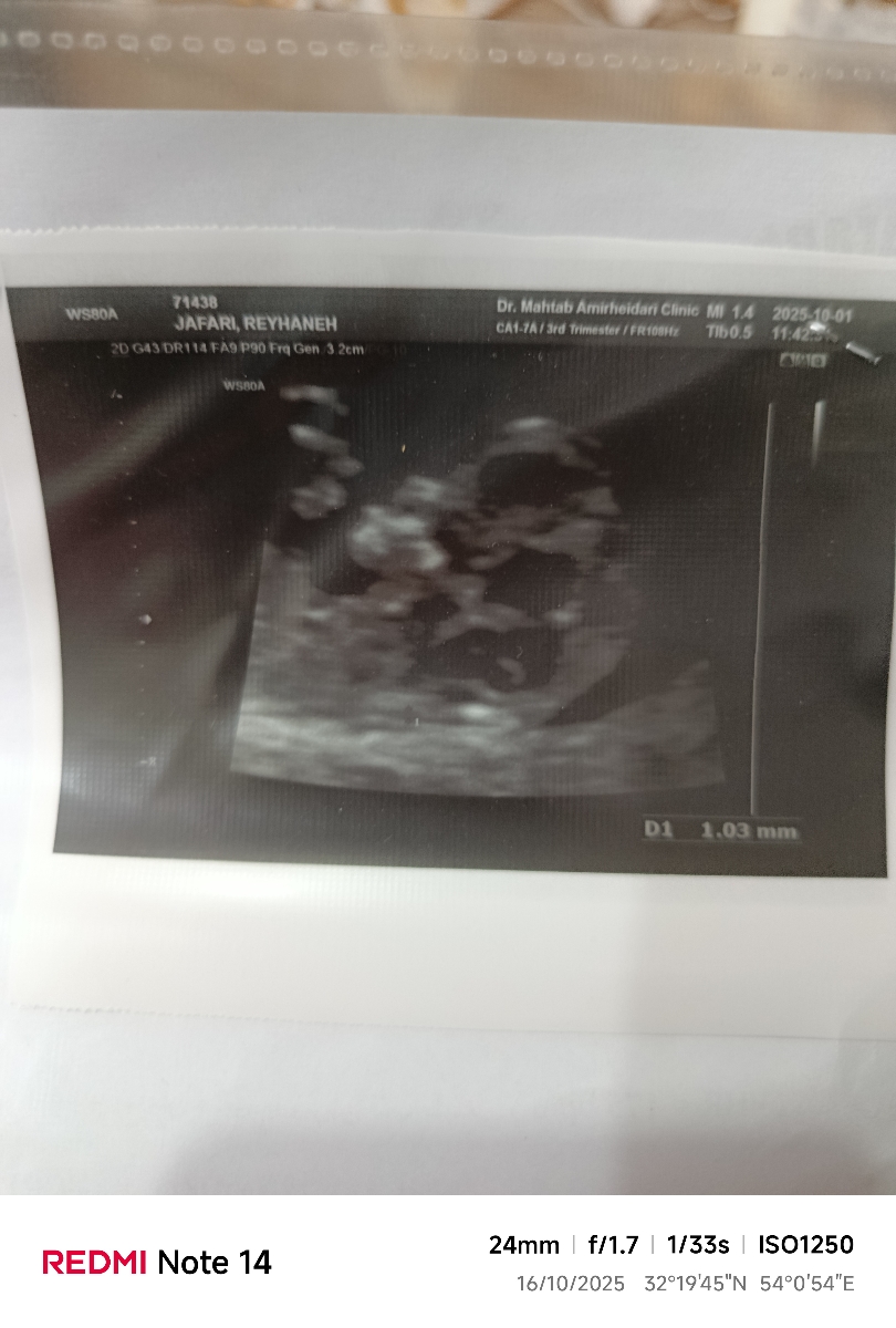 جواب آزمایش؟؟؟؟ احتمال دوقلویی جواب آزمایش؟؟؟؟ احتمال دوقلویی