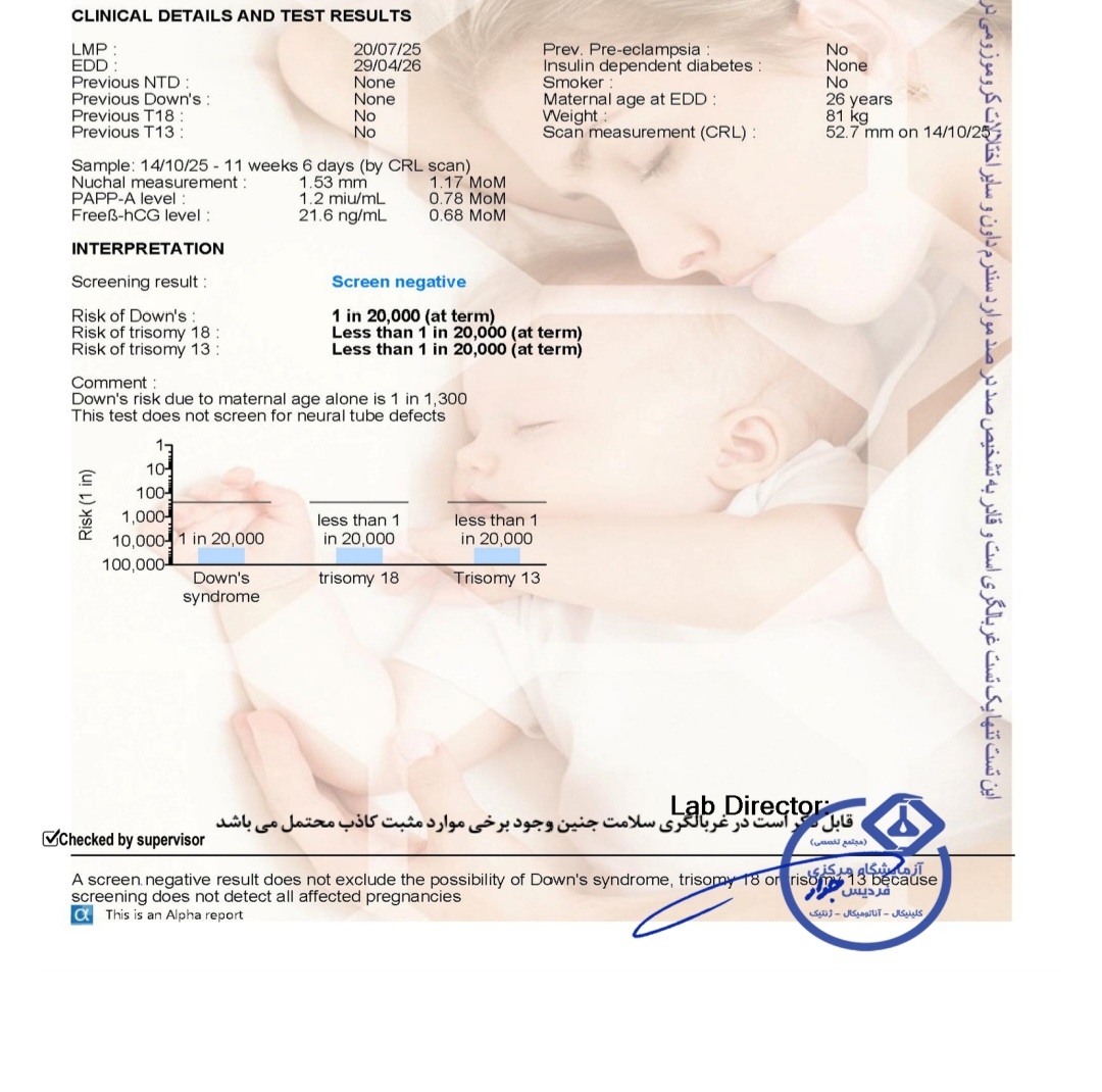 زمان انجام سونو ان تی