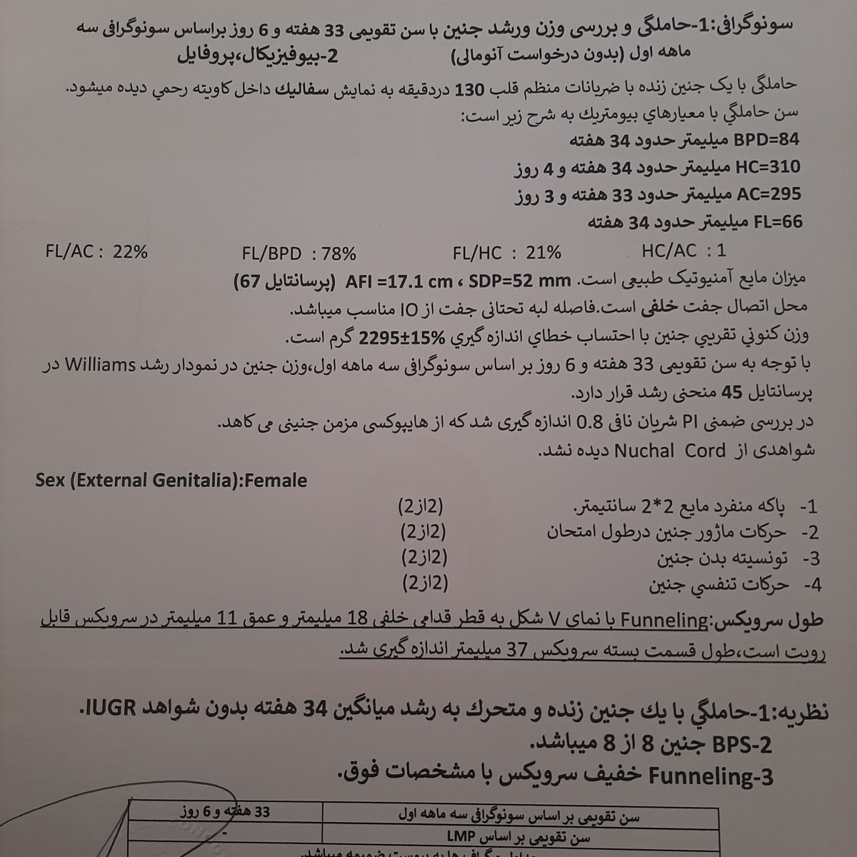فانلینگ با نمای vشکل فانلینگ با نمای vشکل