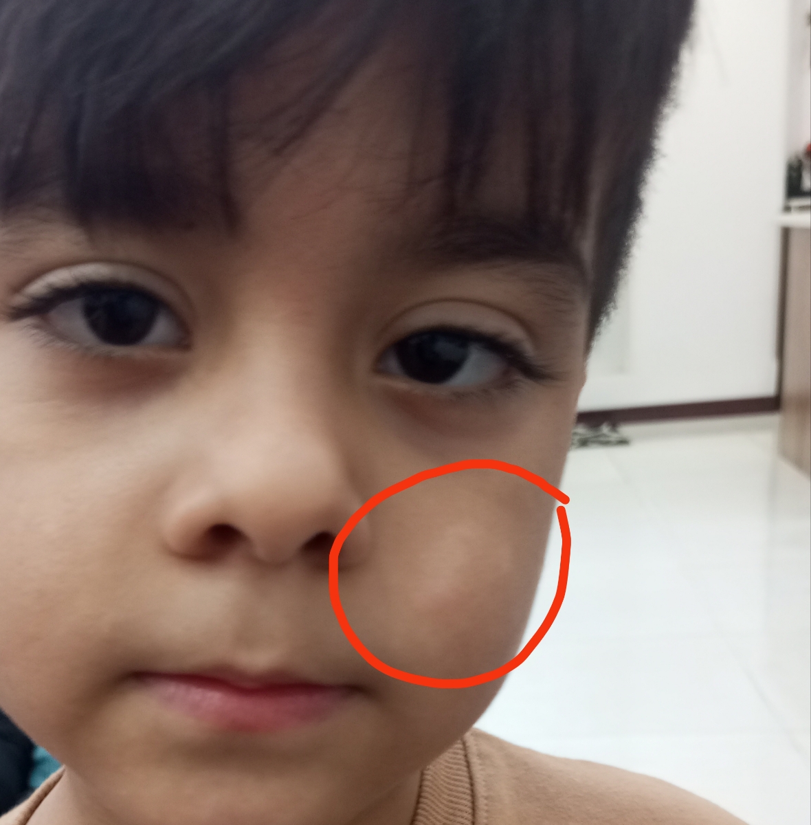 دلیل این لکه پوستی چیه ؟ خطرناکه