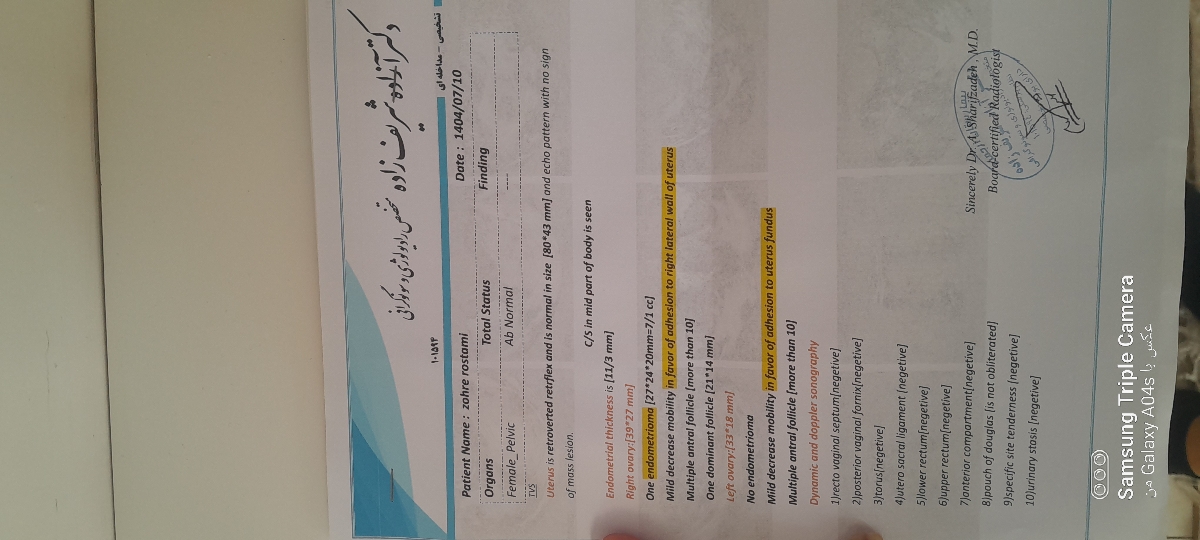 کیست شکلاتی و چسبندگی مانع بارداری میشه؟؟؟؟ همراه با عکس سنو کیست شکلاتی و چسبندگی مانع بارداری میشه؟؟؟؟ همراه با عکس سنو
