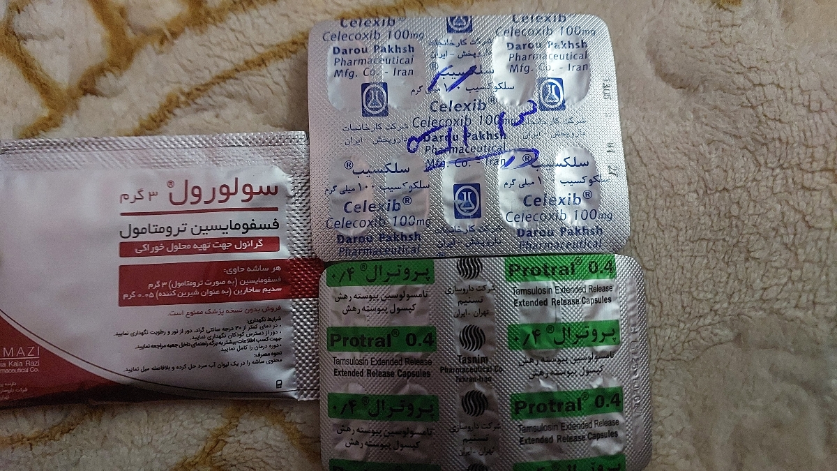 فولنس کلیه خفیف سمت راست