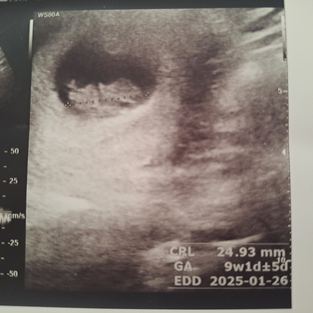 این برا قلبش رفتم این برا قلبش رفتم