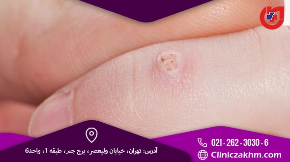 از اینا منظورته از اینا منظورته