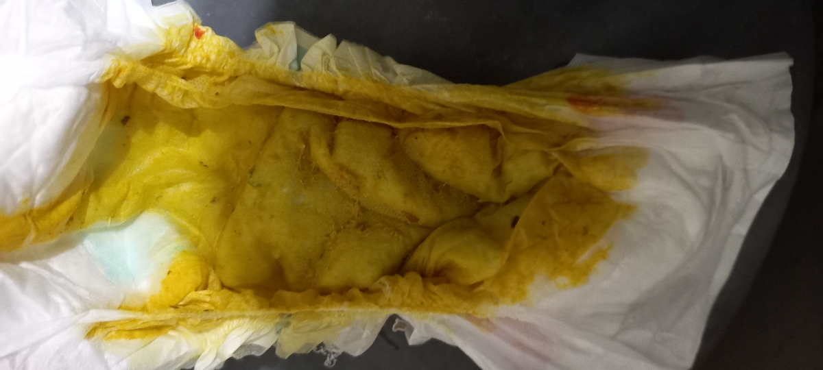 اینم برا الانه اینم برا الانه