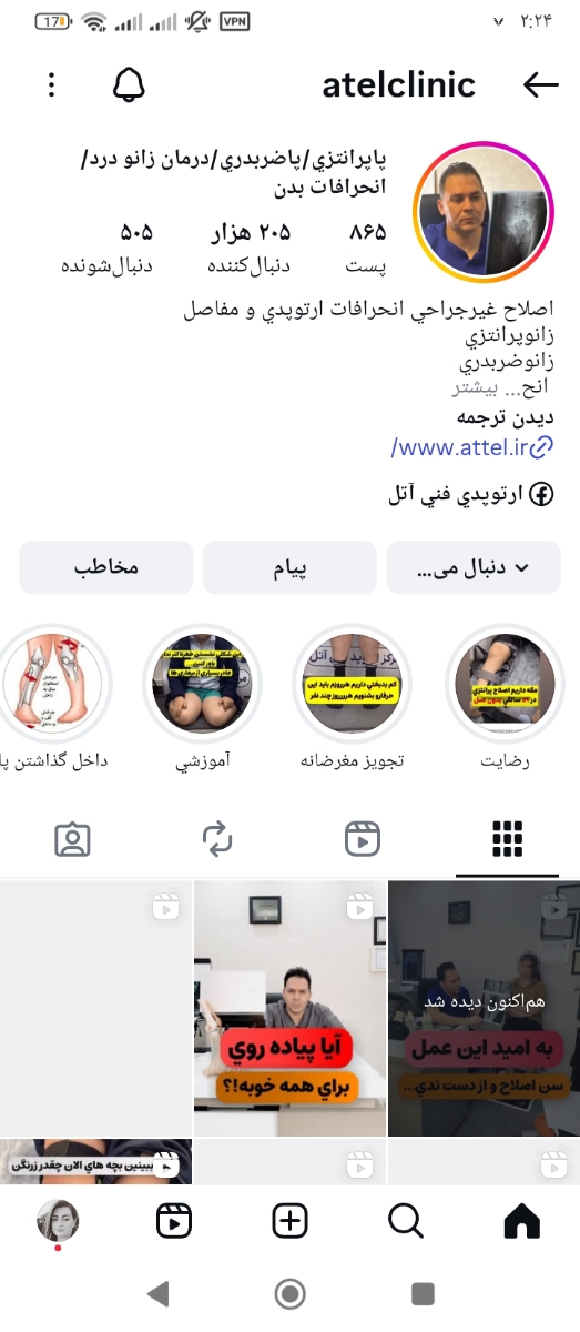 عزیزم اینم پیج دکتر پسرمه برو تو پیجش ببین همه چی رو توضیح داده و بدون جراحی درمان میکنه 