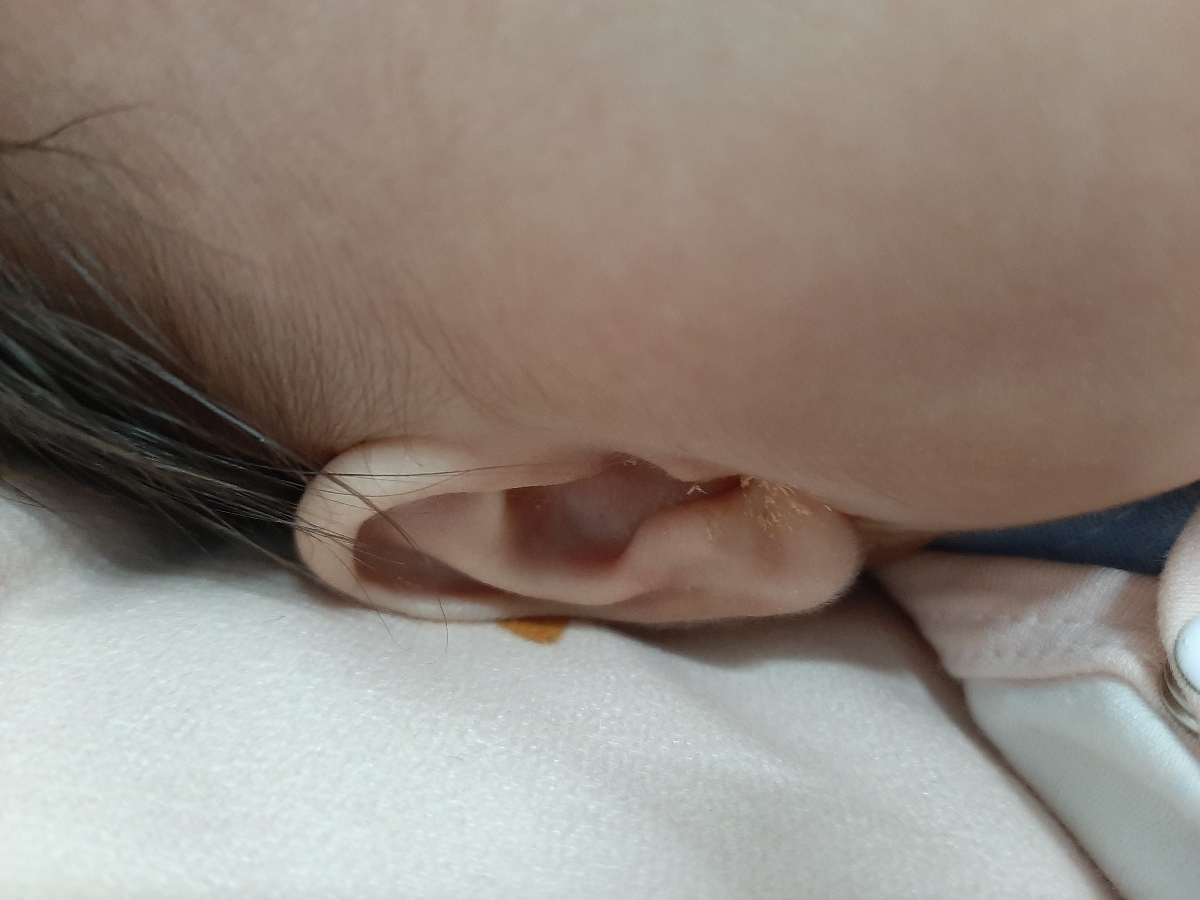 گوش نوزادم درد میکند چه کاری انجام دهم؟!