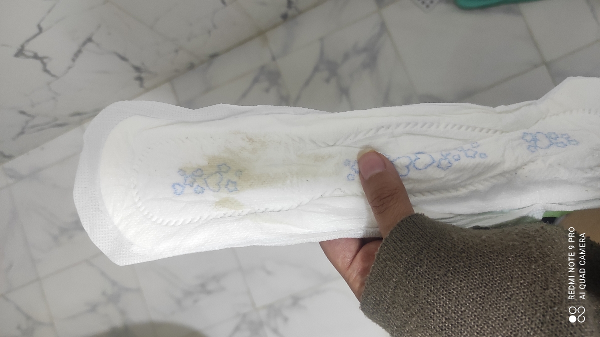 سلام این نوع لکه بینی نشونه چیه سلام این نوع لکه بینی نشونه چیه