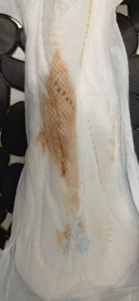 سلام خانوما عکس میزارم اگه حالتون بد میشه نگاه نکنید لطفا