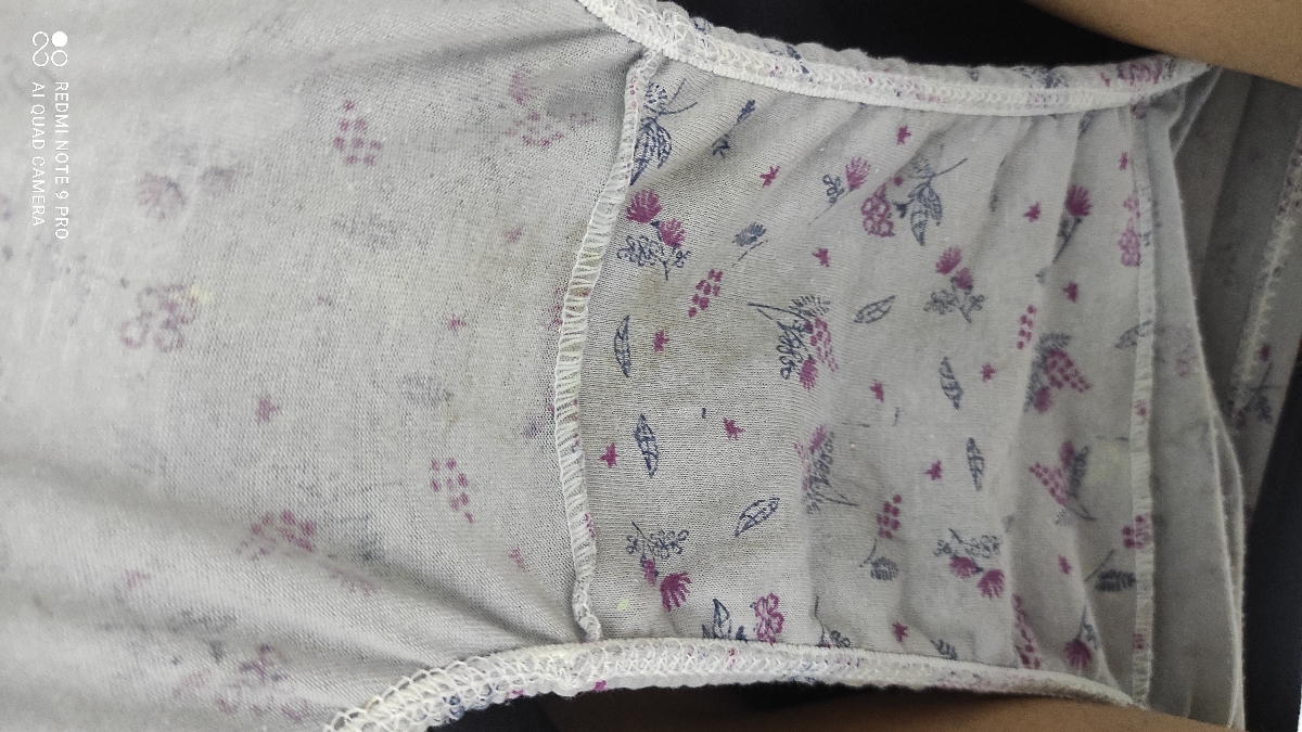 سلام مجدد خانم دکتر من شیاف رو ساعت ۴ عصر دیروز زدم الان صبح ک پاشدم اینطوری بود؟!؟!؟!!!!! سلام مجدد خانم دکتر من شیاف رو ساعت ۴ عصر دیروز زدم الان صبح ک پاشدم اینطوری بود؟!؟!؟!!!!!