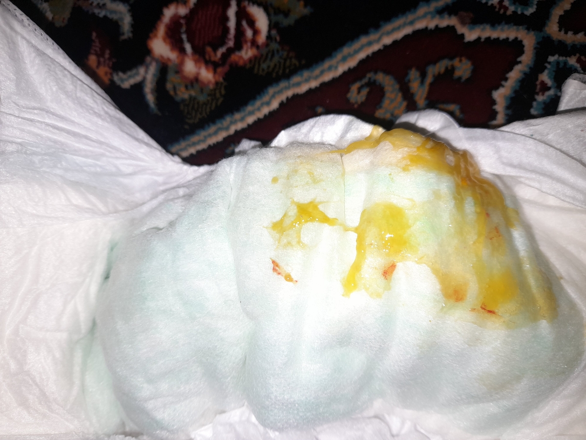 میشه آزمایش مدفوع نوزادمو تفسیر کنید؟