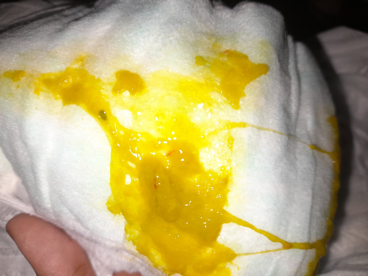 میشه آزمایش مدفوع نوزادمو تفسیر کنید؟