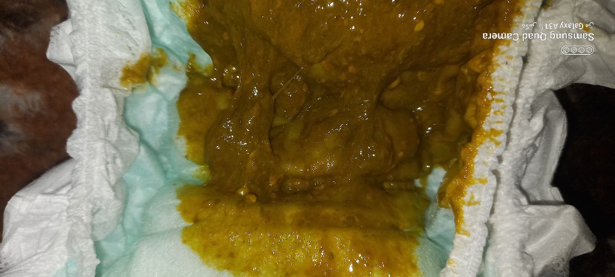 یبوست و مدفوع خلطی .... یبوست و مدفوع خلطی ....