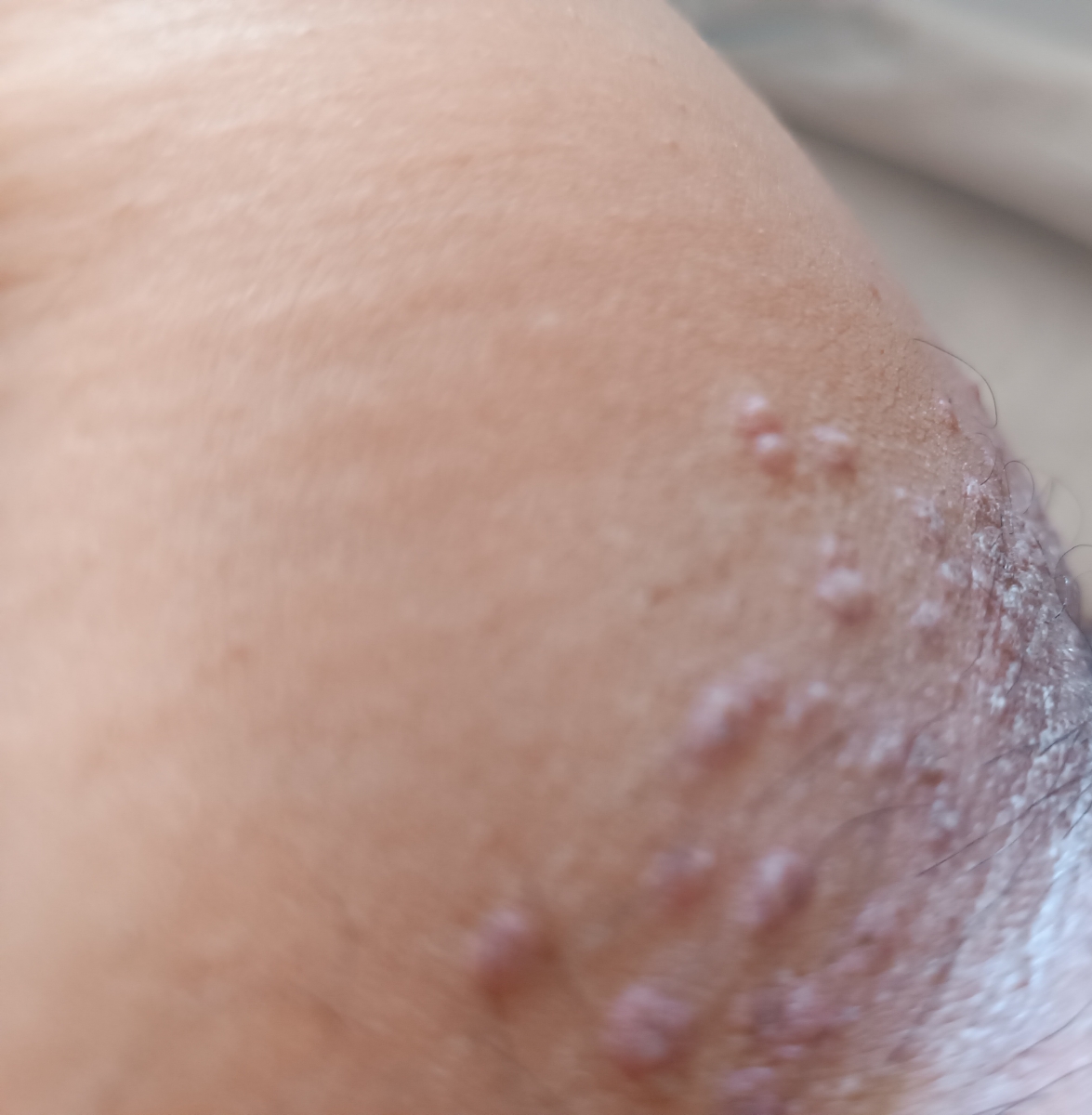 اون قسمت سفید کرم زینک زدم خودم