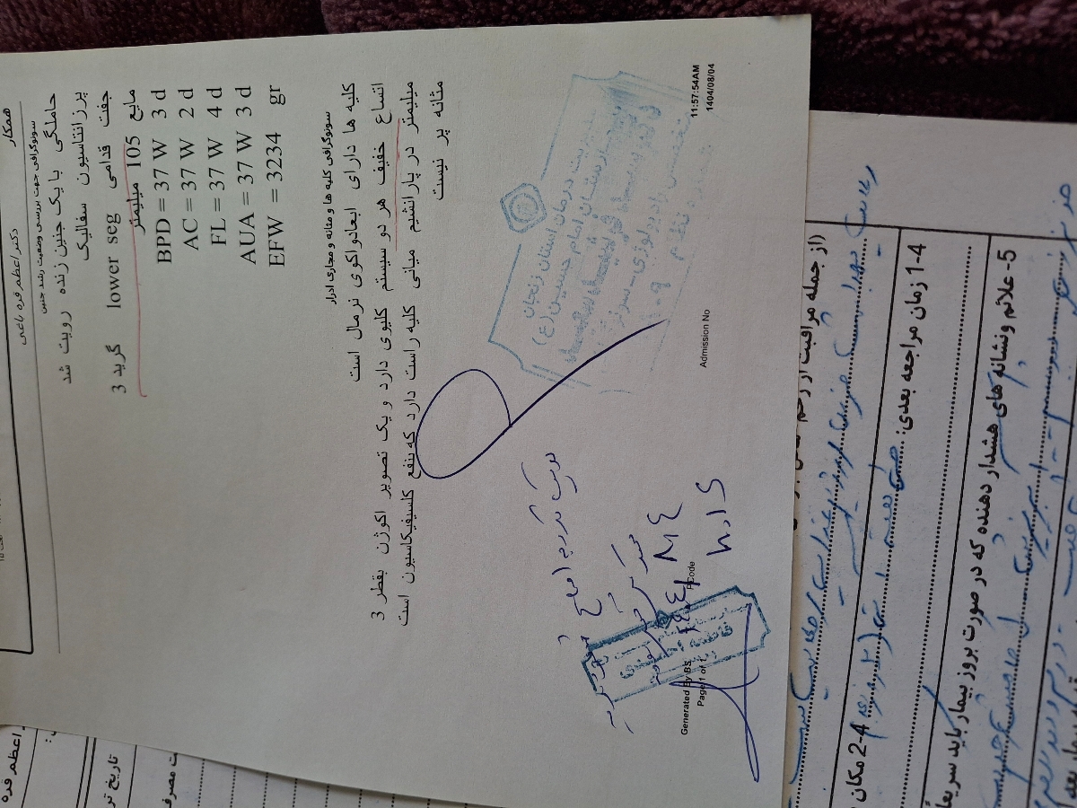 حالم خیلی بده جفتم پایینه