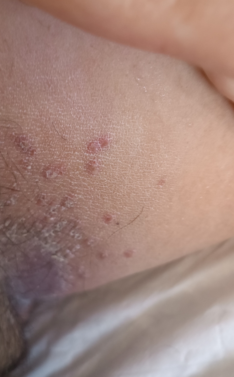 مکمل های هفته ۱۷