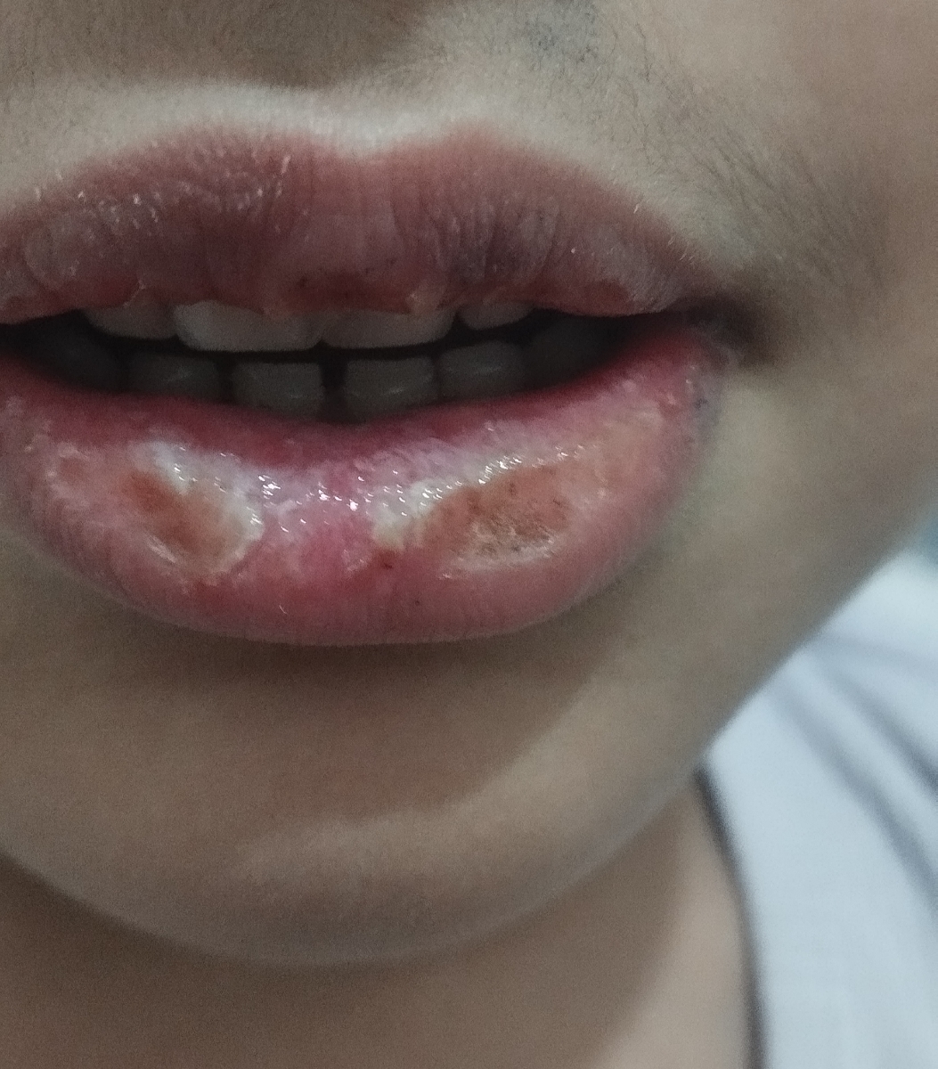 سلام خانم دکتر لب پسرم اینجوری شده