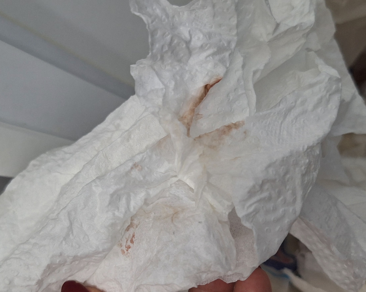 خیلی عذر میخام برای عکسها 🙏