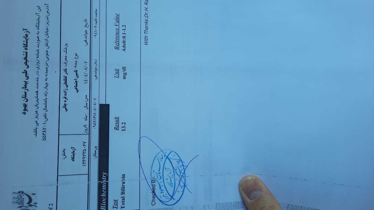 زردی نوزاد 10 روزه