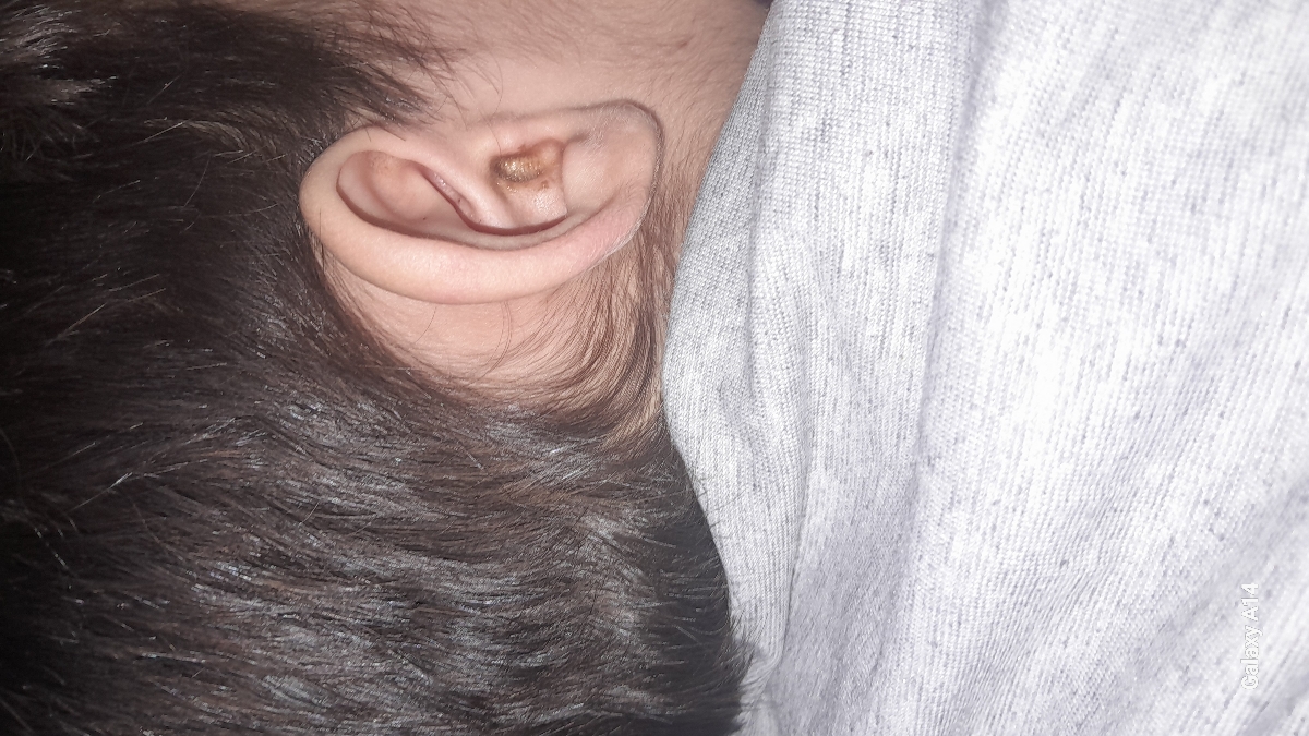 پسر۲سالو۶ماهم ترشح گوش طبیعیه