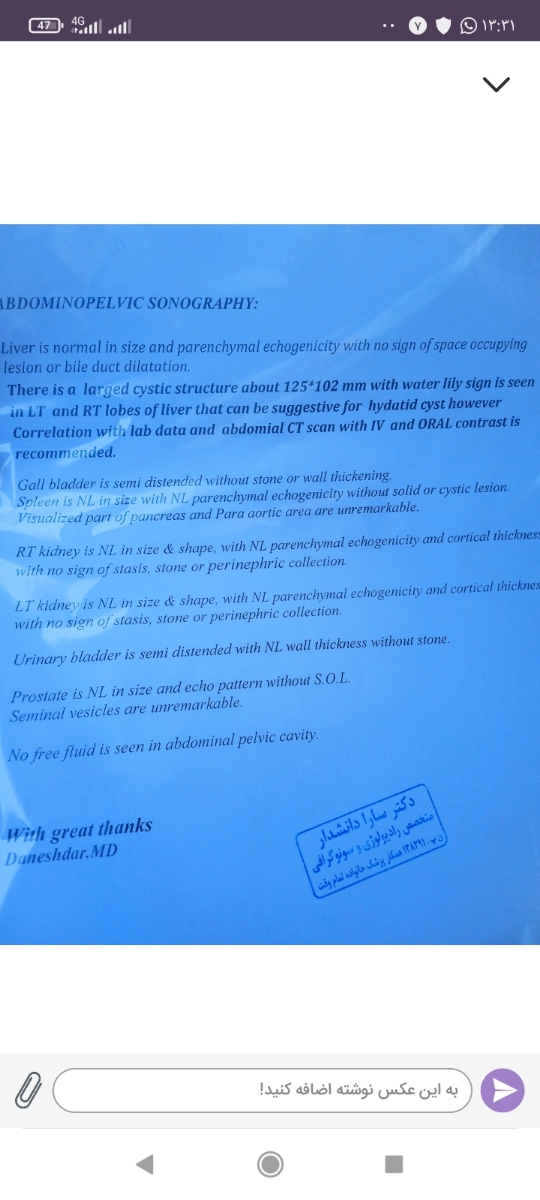 بررسی سونوگرافی شکم بررسی سونوگرافی شکم