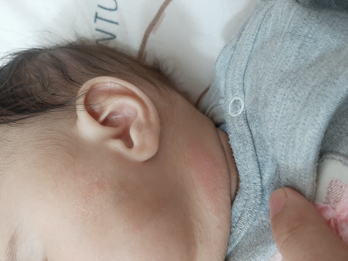 پوست نوزادم قرمز شده چیکار کنم ؟ پوست نوزادم قرمز شده چیکار کنم ؟