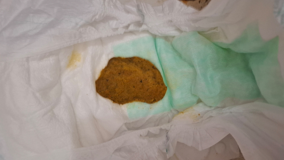 یبوست نوزاد یازده ماهه همراه عکس یبوست نوزاد یازده ماهه همراه عکس