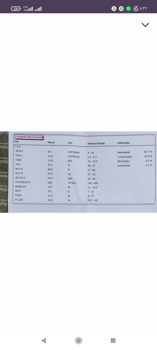 سردرد و سرگیجه بارداری سردرد و سرگیجه بارداری