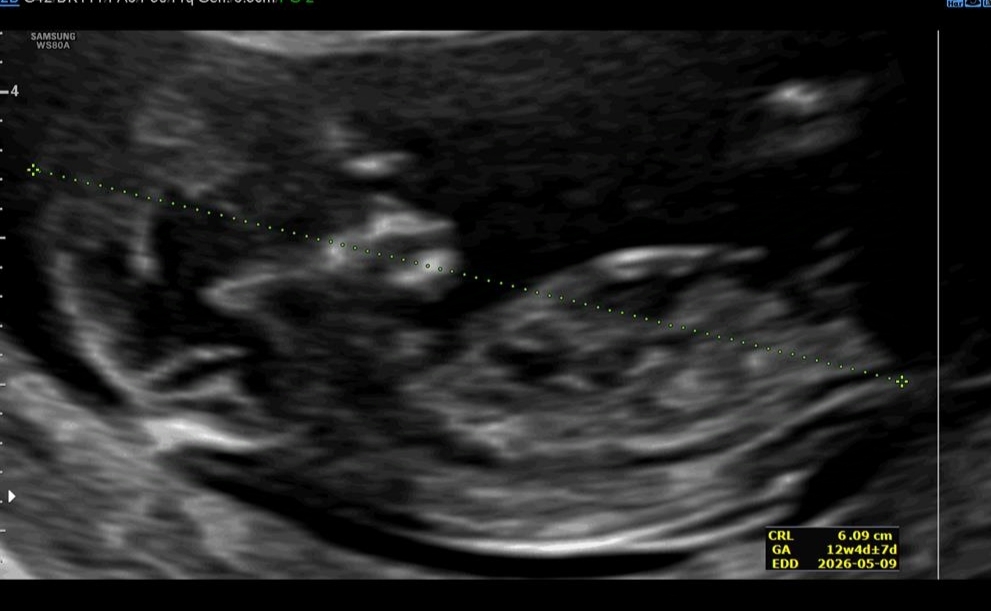 ان تی و جنسیت عکس ان تی و جنسیت عکس