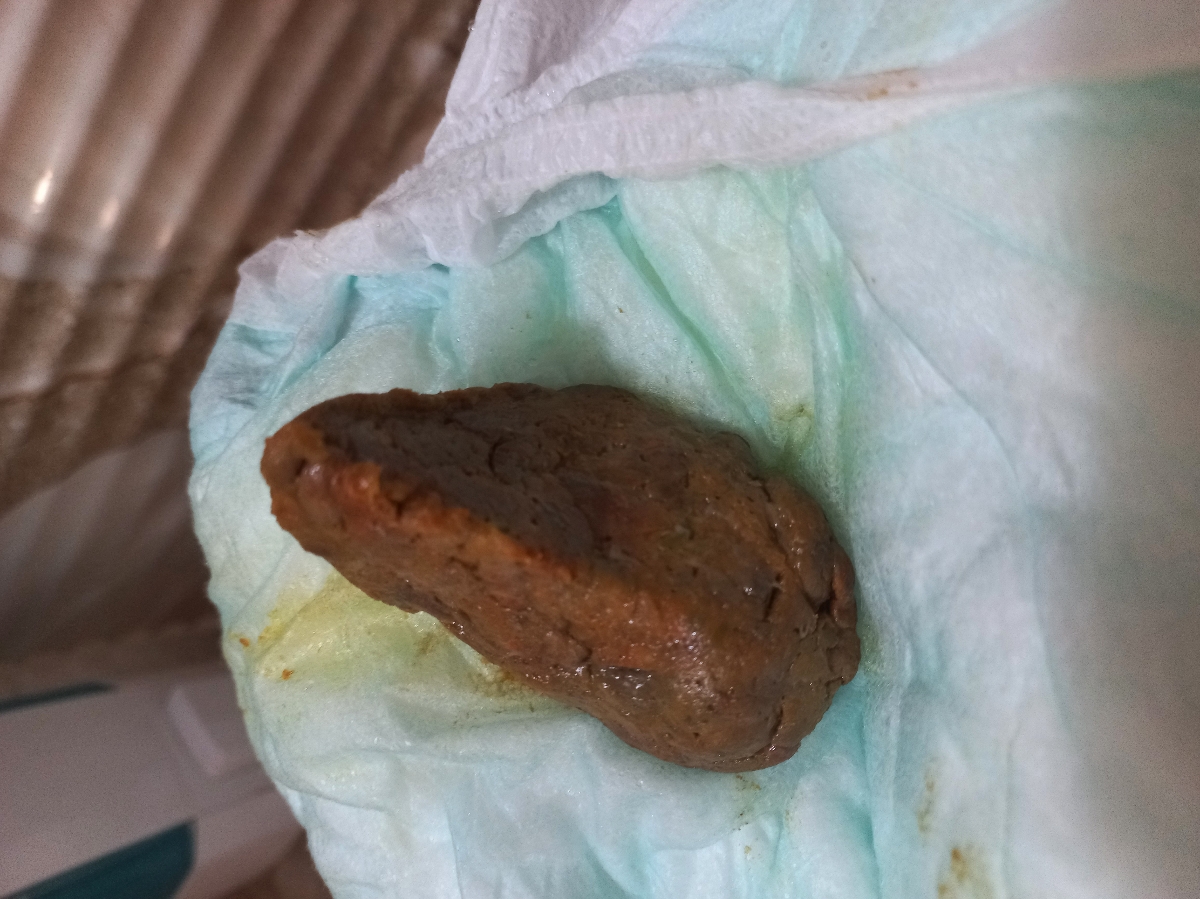 شکل دفعش اینطوریه ببخشید بابت عکس