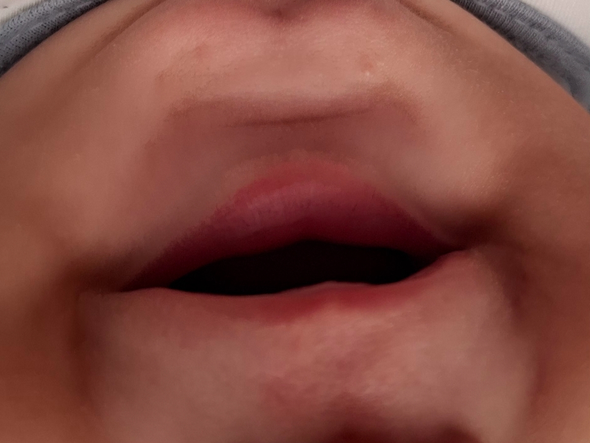 آیا اینا تبخاله؟همراه عکس آیا اینا تبخاله؟همراه عکس